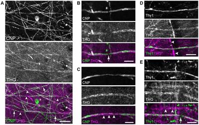 A Method to Measure Myeloarchitecture of the Murine Cerebral Cortex in vivo and ex vivo by Intrinsic Third-Harmonic Generation